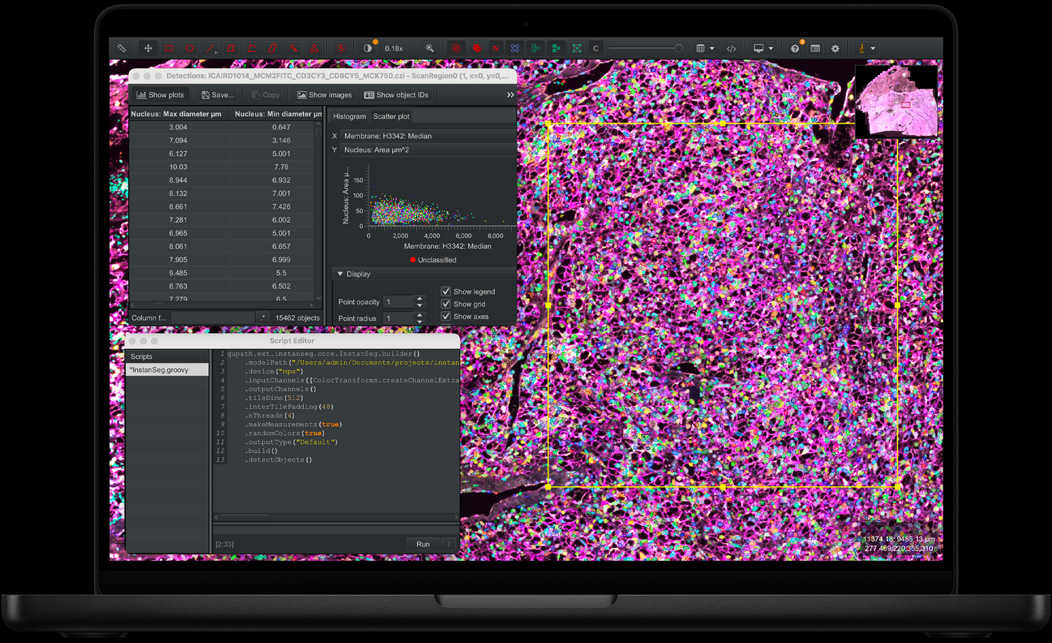 Pantalla de un MacBook Pro que muestra QuPath e Instanseg